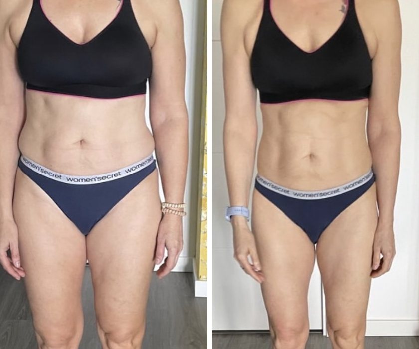 Antes y después de un cliente de Hermetic Way